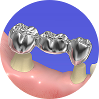 保険適用の素材