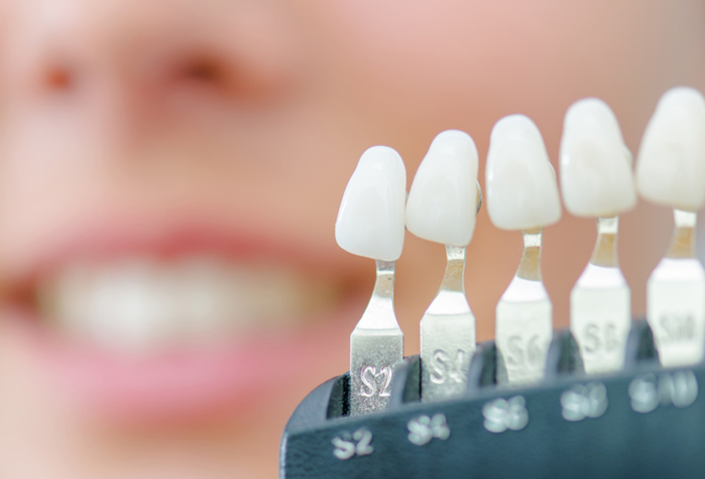 ホワイトニング