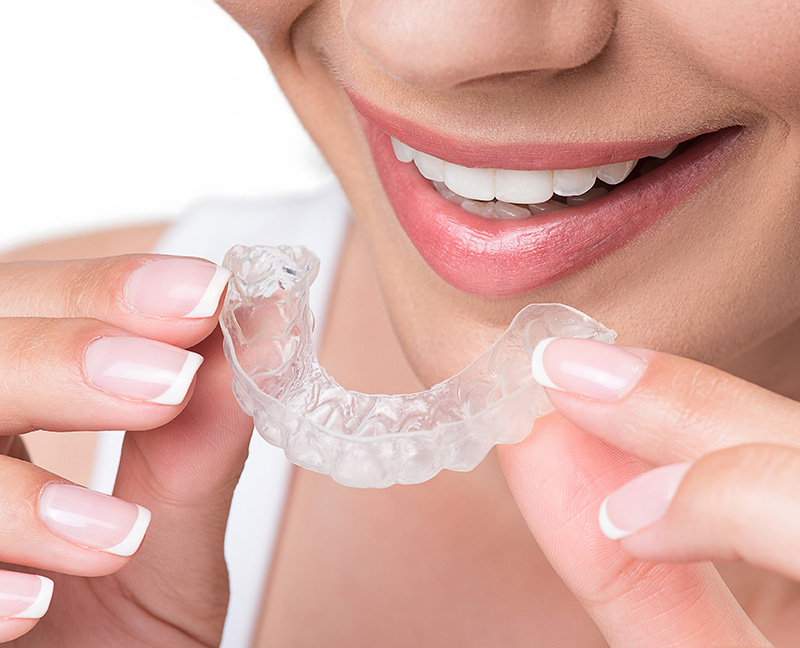 自宅で自分のペースで行う「ホームホワイトニング」