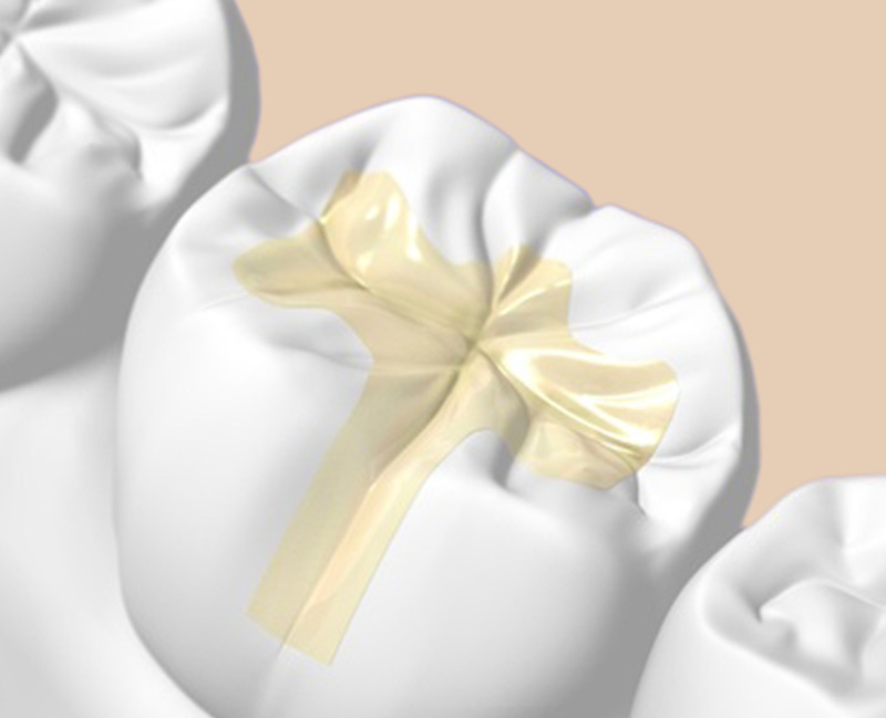 噛み合わせの良い機能的な歯をつくる