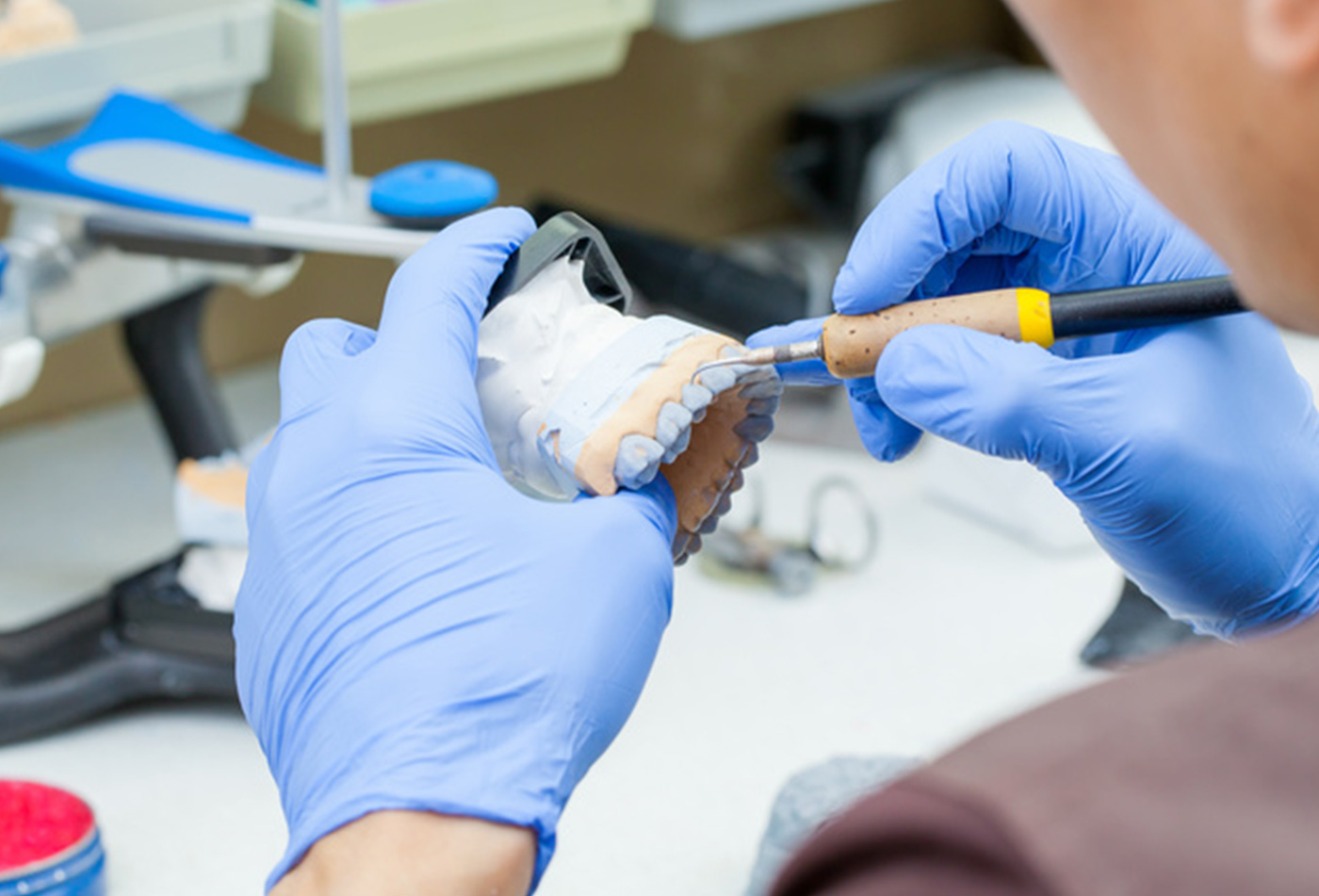 補綴治療に使用する歯科素材